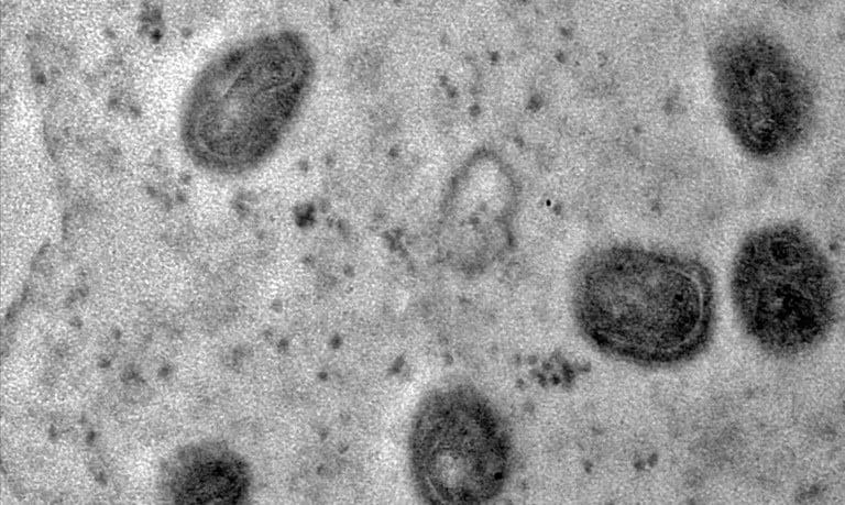 UFMG Desenvolve Vacina Brasileira Contra Mpox em Parceria com MCTI