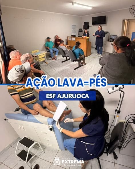 Extrema promove ação “Lava Pés” para cuidado com pacientes diabéticos