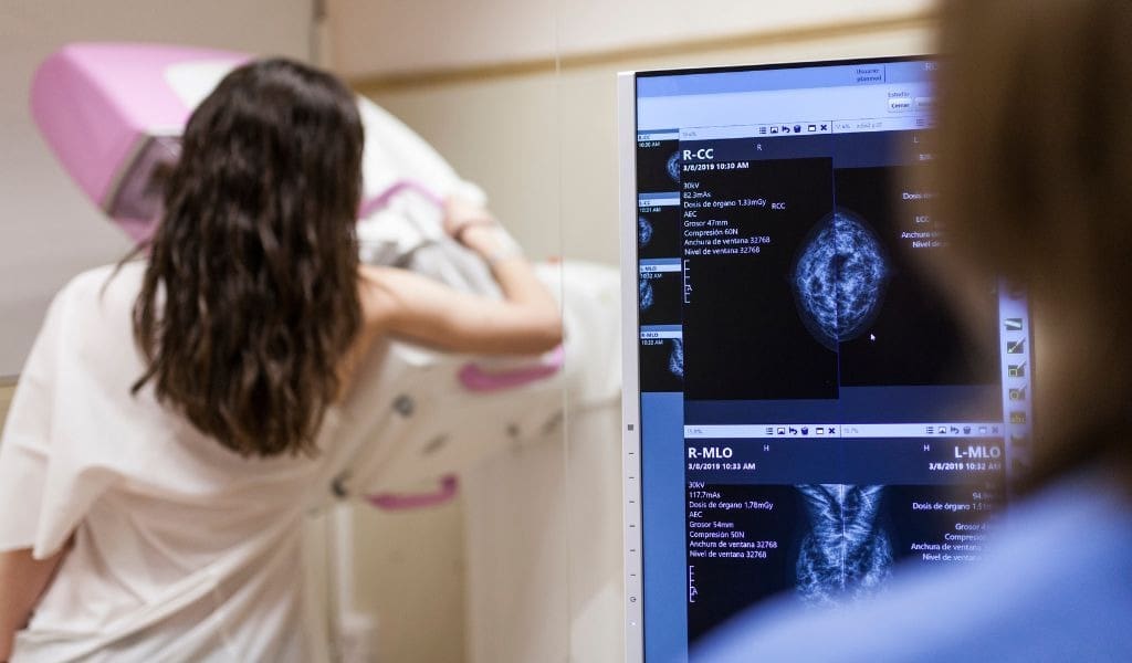 ANS defende que plano cubra mamografia digital sem restrição de idade
